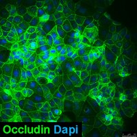 Caco-2/TC-7 Human Colon Adenocarcinoma Cell Line | SCC209